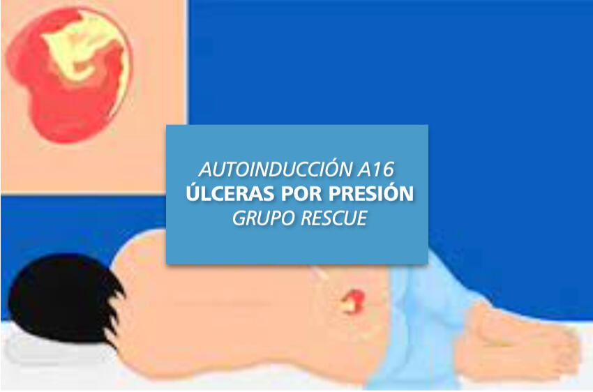 Úlceras por presión Úlceras por presión
